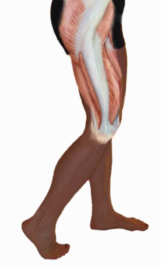 Iliotibial Band - A common source of hip and/or knee pain
